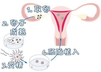 供卵联系方式试管婴儿中心